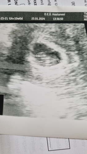 IMG-20240123-WA0007