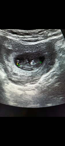 Screenshot_20250428-013617