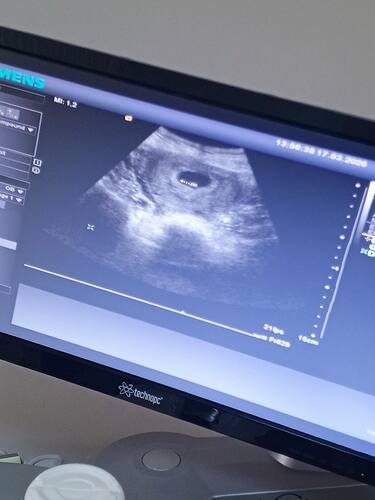 IMG_20260317_140603_158