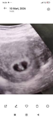 Screenshot_2026-03-14-16-26-05-285_com.miui.gallery