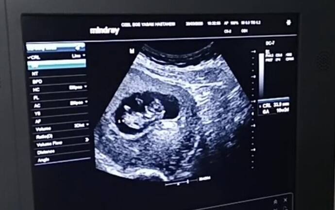 IMG_20260328_142619_868