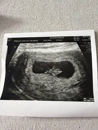 IMG_CC4EB2F0-80DD-40C1-B4B8-C3AA5E1517E1