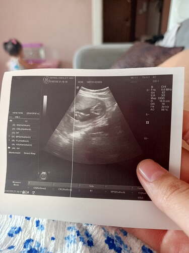 IMG_20250722_093651_241