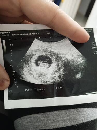 IMG_20260325_203216_827