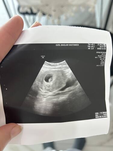 IMG_5B2673BE-B59F-451B-8D69-F7ED3A2EA2C8