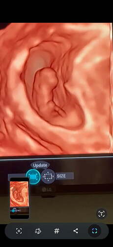Screenshot_20250805_102321_Photos