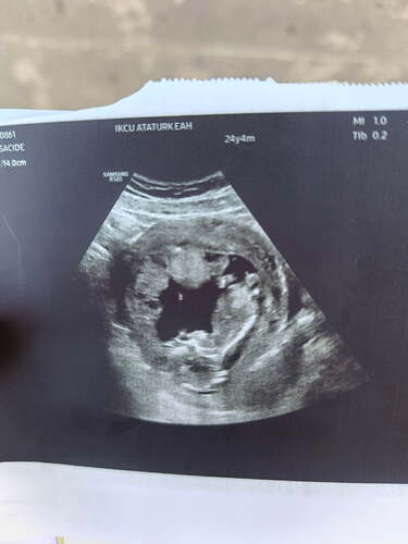 IMG_20260421_101140_063