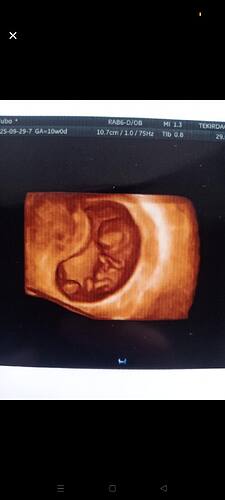 Screenshot_2025-09-29-23-00-25-52_96b26121e545231a3c569311a54cda96