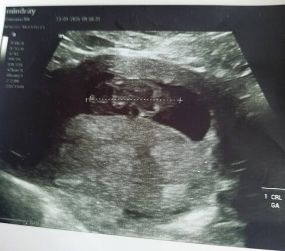 IMG_20260313_105540_1