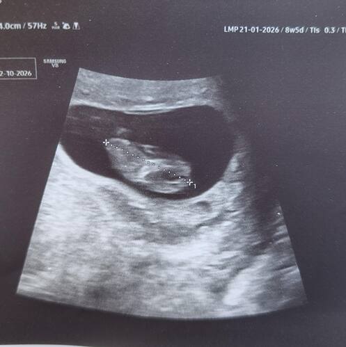 IMG_20260323_103314_228