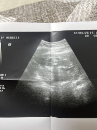 IMG_5DB4611E-780A-478C-89F1-EF4D294EC900