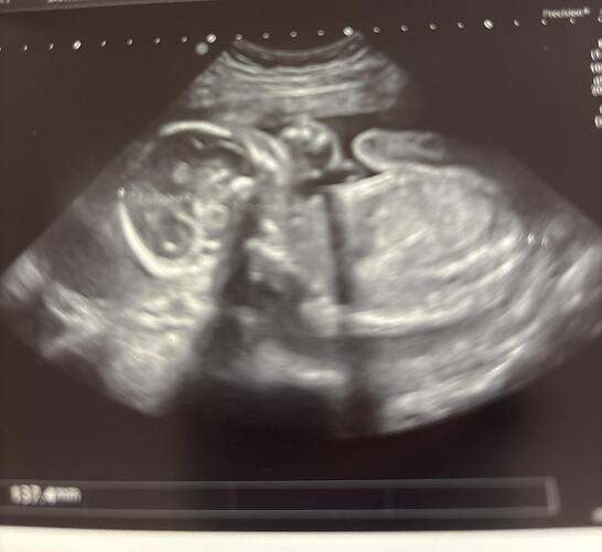 IMG_E4770605-2695-4DC9-BE8A-627565EB5611