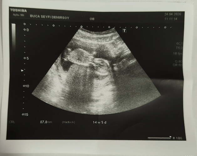 IMG_20260424_224627_589