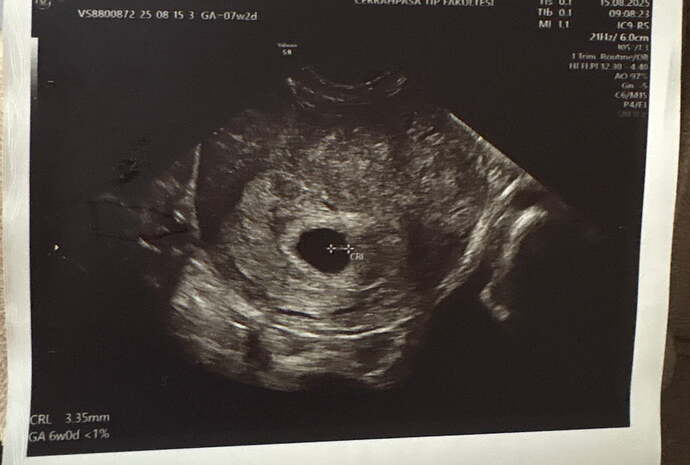 IMG_8AA5115A-C894-4D22-97A8-A9FB224ED09B