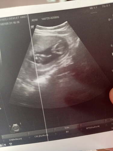 IMG_20250722_093655_959