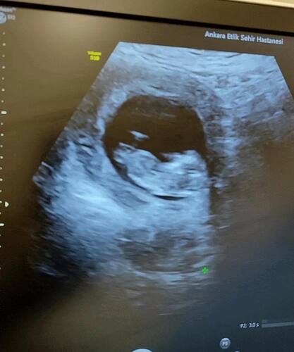 Screenshot_2026-03-01-13-15-37-457_com.google.android.apps.photos-edit