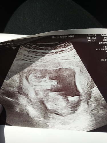 IMG-20260804-WA0001