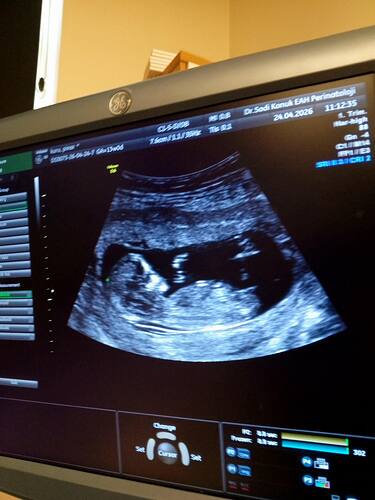 IMG_20260424_111422_814