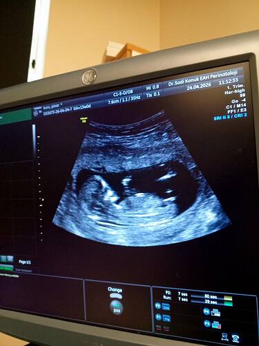 IMG_20260424_111413_133