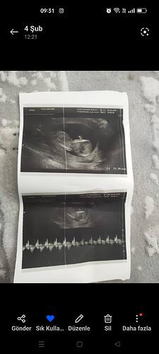 Screenshot_2026-02-13-09-31-28-53_99c04817c0de5652397fc8b56c3b3817